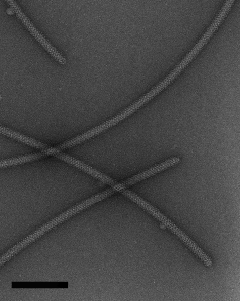 Eredmények 14. ábra: Negatívan festett filamentum-sapka komplexumokról elektronmikroszkóppal készített mikrográf. A nagyítás 50000-szeres, a lépték 100 nm-t mutat.