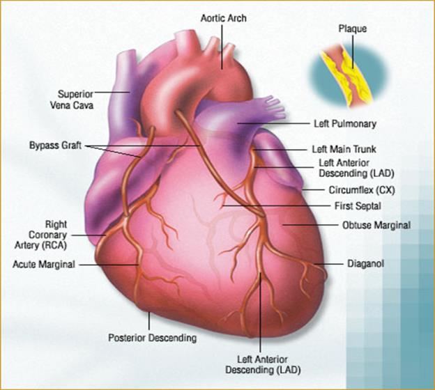 Az iszkémiás szívbetegség, Kamrai ritmuszavarok Dr.