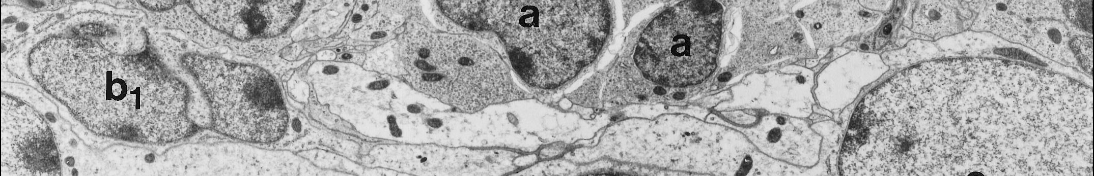A migráló neuroblasztok (A-sejt) GFAP-in, Dlx-2-ip és PSA-NCAM-ip-ak (Mudo és mtsai 2009).
