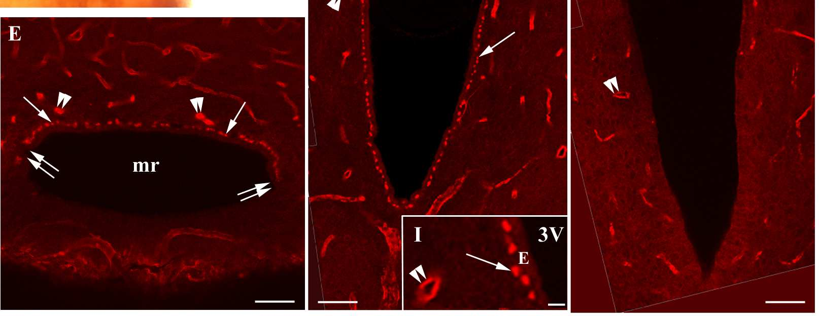 A lumennel rendelkező kapilláris (kettős nyílhegy) elkülönül ezektől. E-ependima. Skála: 5 µm.