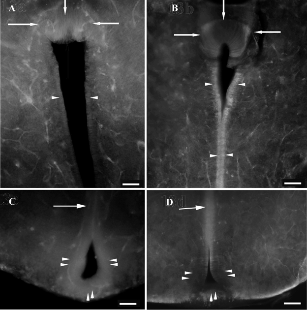 tól ventrálisan elhelyezkedő ependimájában (nyíl) Ap4-immunpozitivitás volt megfigyelhető. Skála B: 80 µm, C: 40µm. D: A PVO-ból (nyíl) is hiányzott az Ap4 és a β-dg-ip globulusok. Skála: 40 µm. 25.