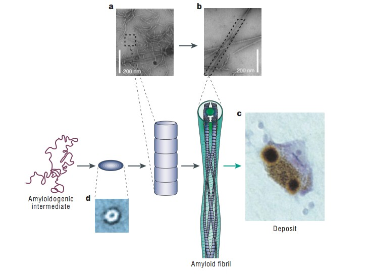 gombolyodás és aggregáció Amiloid plakk