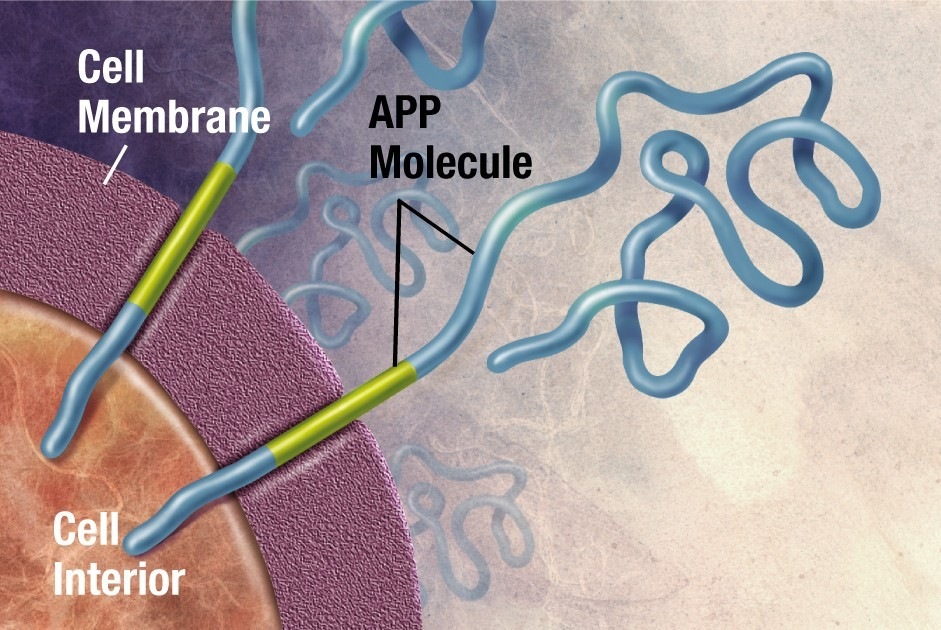 Amiloidok és prekurzor fehérjéik Alzheimer kór, β amiloid