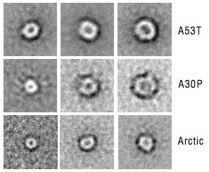 toxikusabbak, mint az amiloid plakkok