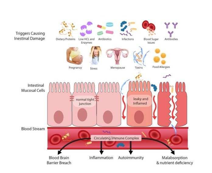 GRD (gluten related disorders) Autoimmun Cöliakia Gluten ataxia Dermatitis herpetiformis Duhring Glutén (búza) allergia Légúti allergia