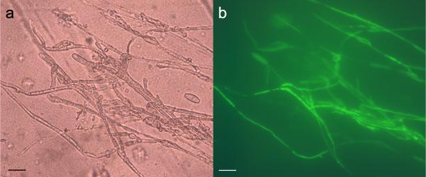 A második célkitűzés keretében két eltérő genotípusú Ampelomyces-törzset transzformáltunk Agrobacterium által közvetített transzformálással (Gorfer et al. 2007).