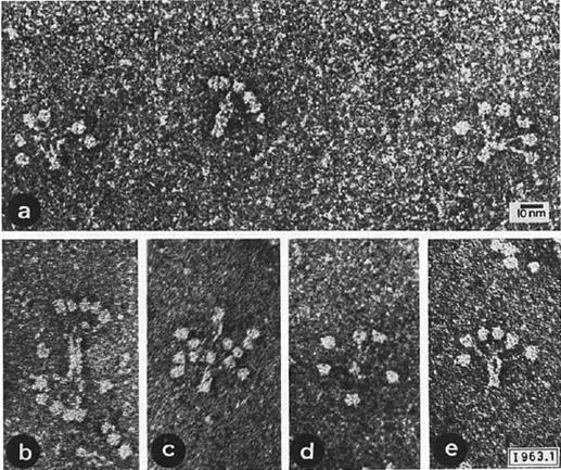 fibrillumok apoptotikus sejtek patogének Fibrilláris részhez kötődnek: C1q-receptrok, C1q-kötő molekulák, amik