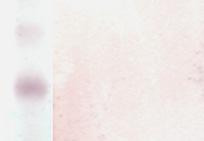M - 100 bp DNS molekulasúly marker (Promega); 1. S. griseus 45H; 2. S. griseus 45H-B; 3. S. europaeiscabiei CFBP4501; 4.