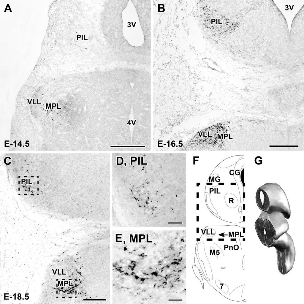 5. ábra A TIP39-et expresszáló neuronok a subparafascicularis terület caudolateralis részében (SPF-PIL) és a ponsban, a medialis paralemniscalis mag területén (MPL). (A) A 14,5.