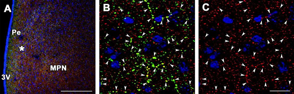 Pons A ponsban a nucleus tegmentalis dorsalis (ahol intenzív mrns in situ hibridizációs jelet láttunk) kivételével csak kevés, szétszórt PTH2 receptort kifejező neuront találtunk a tegmentum, a