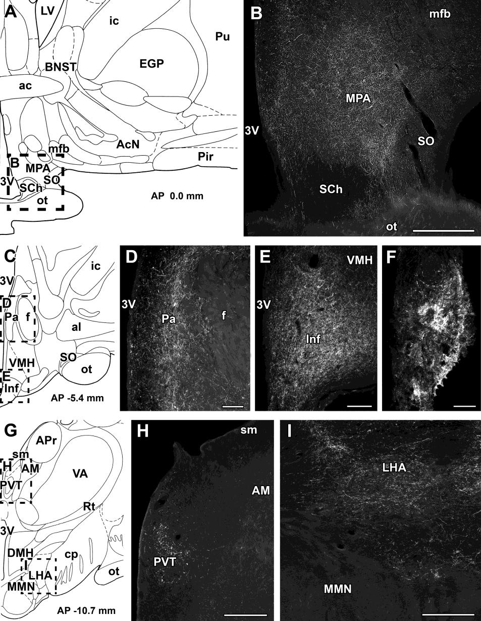 15. ábra Humán diencephalon PTH2 receptor immunreaktivitás vizsgálata FITC-tiramid fluoreszcens amplifikációs immuncitokémiával coronalis metszeteken.