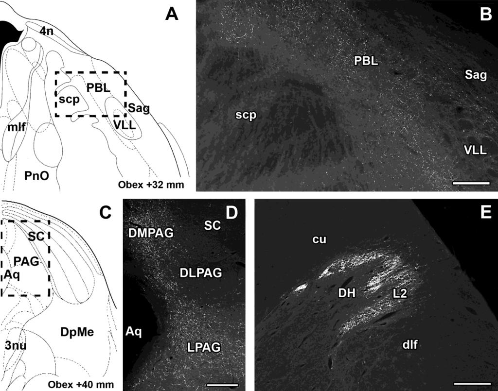 16. ábra PTH2 receptor immunreaktivitás vizsgálata humán mesencephalon, a pons és a medulla oblongata területén FITC-tiramid fluoreszcens amplifikációs immuncitokémiával coronalis metszeteken.