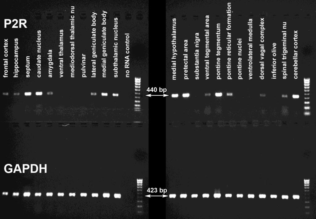 17. ábra PTH2 receptor expresszió kimutatása humán agy különböző területeiből származó mintákból reverz transzkripciós PCR technikával.