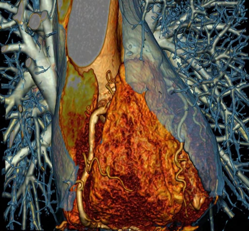 Coronaria CT angiographia Dr.