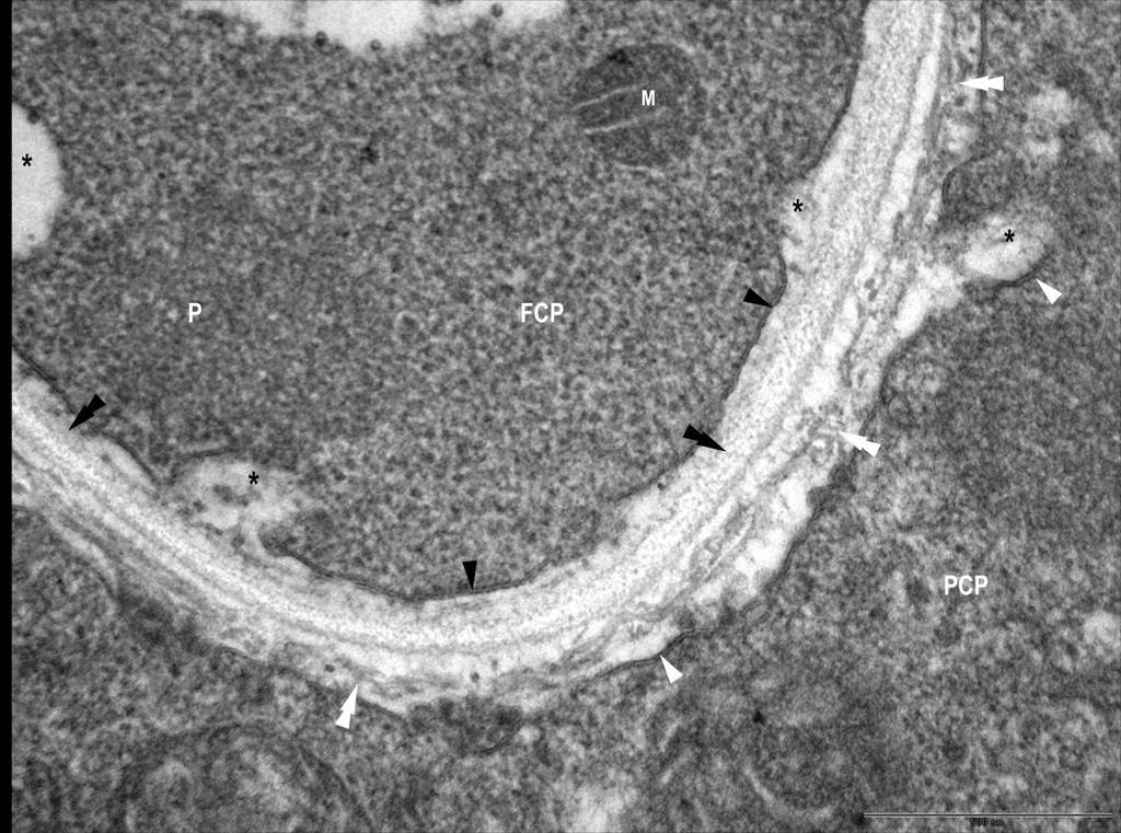 FCP: gomba citoplazma, M: mitokondrium, N: gomba sejtmag, P: peroxiszóma, PCP: növény citoplazma, PP: polifoszfát szemcsék, PV: növényi sejt vakuolum, V: gomba