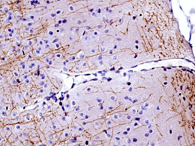 MBP in adult rat brain, corpus striatum.