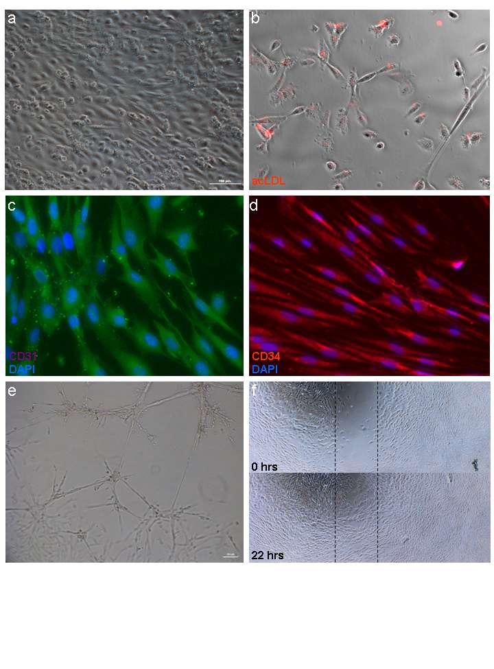 33.ábra3. 3 3. ábra. Humán embrionális őssejtből differenciált endotheliális progenitorsejtek.