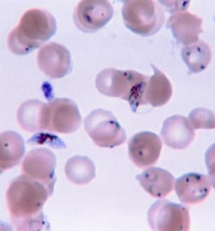 Egysejtes protozoa Plasmodium (malaria)
