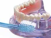 IMPLANT fogkefék rendelkezőknek mindennapos szájhigiéniához implant / brush implant / monotip Kicsi fogkefefej a szájban lévő implantátumok tisztítására.