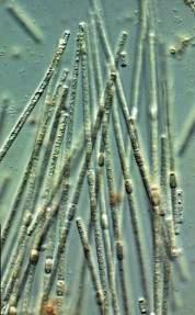 (Nyéki-szállás, Sós-ér) Euglena sp Szabadon úszó sejtek. Az Euglena fajok alakja lehet hengeres, orsó, lekerekített formájú.