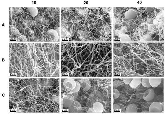 A trombus vörösvérsejt-tartalma (teljes térfogat %-ban kifejezve) 11. ábra Fibrinogénbıl vörösvérsejtek jelenlétében in vitro képzıdött fibrinháló.