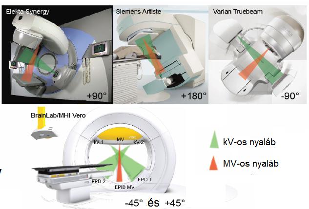 kollimátorfejbe beépíthet k. Ez egyszer síti a kivitelezést, így költséghatékonyabb. A kilovoltos CT-k és CBCT-k azonban magasabb kontrasztú képet adnak.