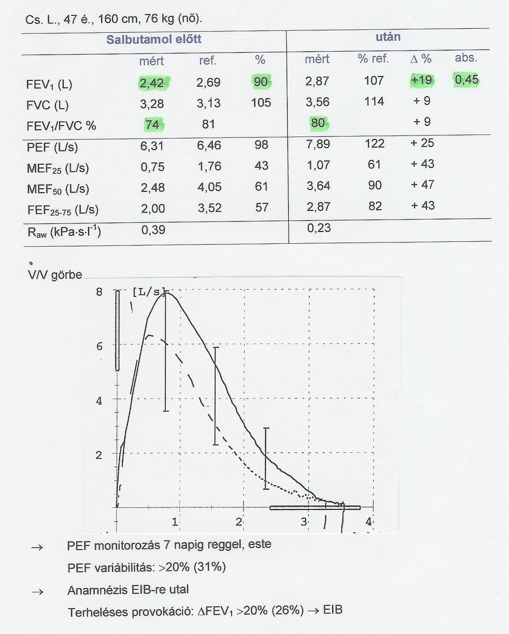 TÜNETMENTES ASTHMÁS (FEV1, FEV1/FVC TÜNETMENTES A NORMÁL