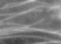 Listeria monocytogenes F-aktin