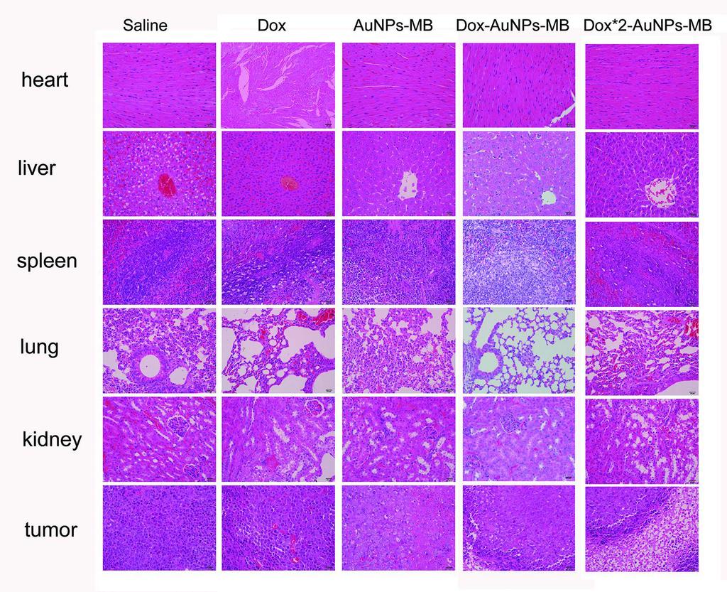 Tumor inhibíció és mellékhatások In vivo Feláldozás és a különböző szervek / szövetek vizsgálata Dox: szív és lépkárosodás, tumorban alig történt
