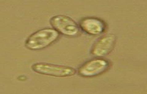 : Diplodia seriata): ugyancsak opportunista nekrotróf kórokozó faj, sok gazdanövénye ismert, s az almafa oltványokat is fertőzi, károsítja, mint a Nyírség-Kert Kft. gyümölcsösében (6.-7. ábrák). 6.