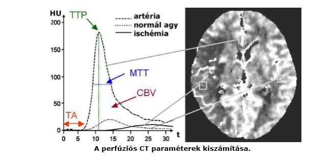 4. ábra Perfúziós