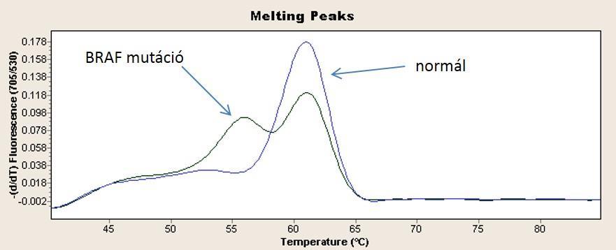 3.3 Szomatikus onkogén génmutációk vizsgálata A BRAF gén 600-as kodon rs113488022 számú, a HRAS gén 61-es kodon rs28933406 számú, az NRAS gén 61-es kodon rs79057879 számú és a KRAS gén 12-es kodon