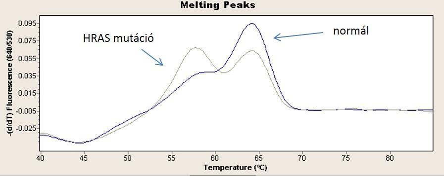 VII. ábra: HRAS mutáció olvadáspont görbéje VIII. ábra: NRAS mutáció olvadáspont görbéje 3.