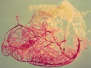 A CORONARIA KERINGÉS PHYSIOLOGIÁJA ÉS PATHOPHYSIOLOGIÁJA III. 10.