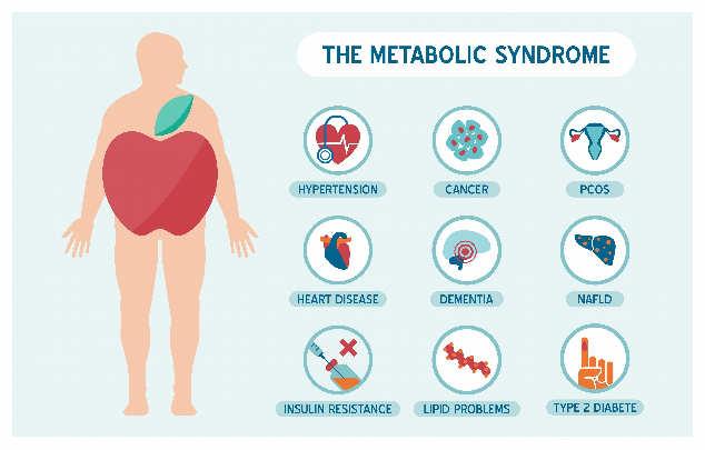 METABOLIKUS SZINDRÓMA A metabolikus szindróma fogalma,
