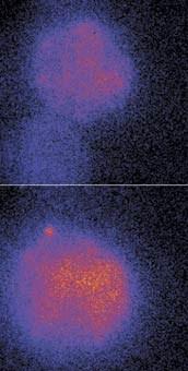 Mérés luminométer felépítése Példák: detektor emissziós monokromátor liposzóma + fluorofór fényforrás analizátor liposzóma + Ca minta fúzió után gerjesztési monokromátor polarizátor 29 30 DNS és