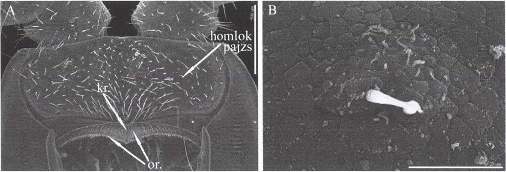 Л: clypeus and labnim of Dicellophilus carniolensis alter removing the forcipules and maxillae. B: clypcal area (Geophilus flavus). (kr. mid-piece of labrum; or. - side piece of labrum).