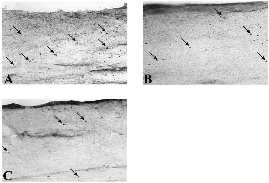 treated animals. In contrast, the mean density of RMO-14 immunorective axonal profiles showed no significant differences in either brain areas.