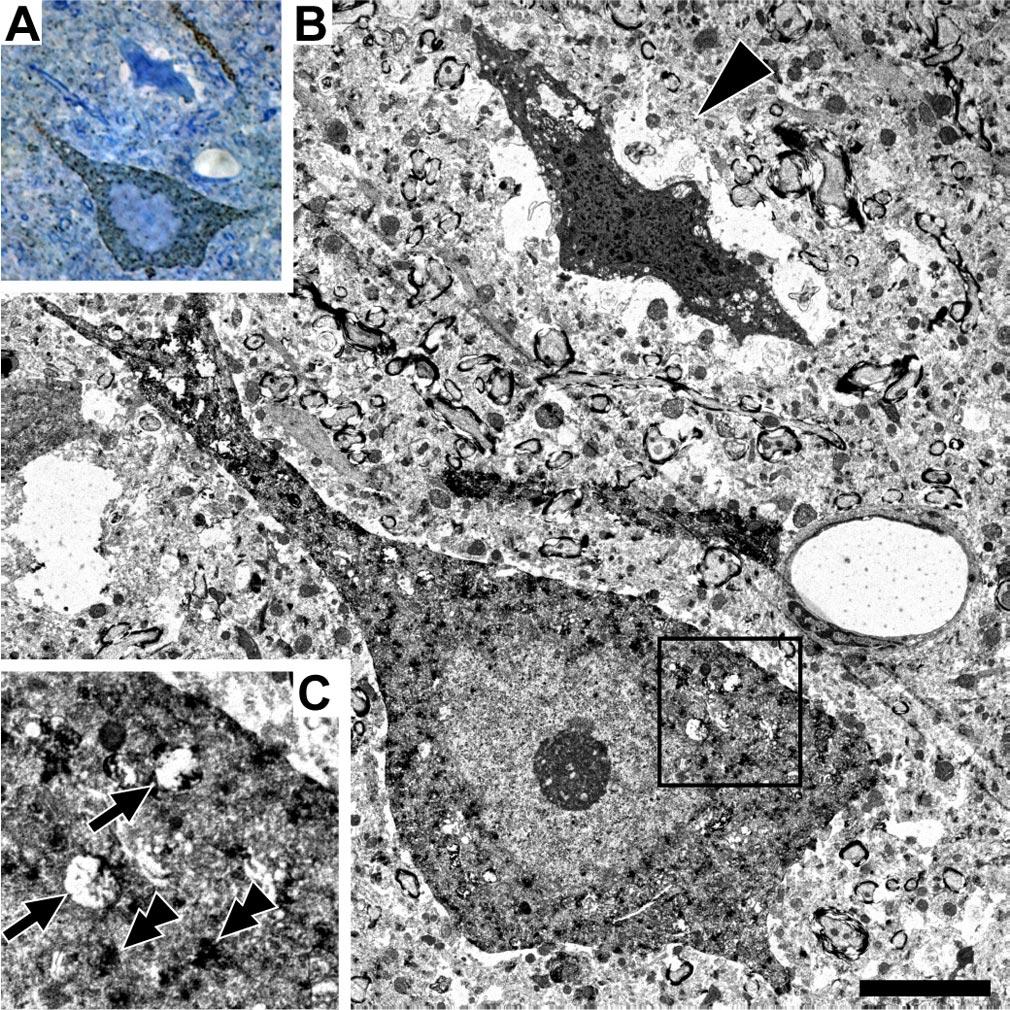 3136 J. Neurosci., March 22, 2006 26(12):3130 3140 Farkas et al. The Consequences of Mechanoporation in DTBI Figure 7.