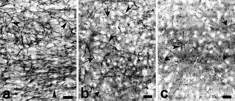 231 moved at a right angle to a straight line drawn vertically through the center of the picture screen of the electron microscope, and the myelinated axons just reaching this straight line were
