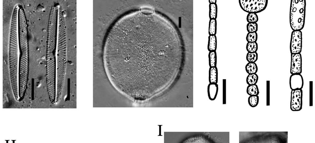 E) Cylindrospermopsis raciborskii, F) Sphaerospermopsis aphanizomenoides, G) Cuspidothrix issatschenkoi, H)