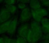 NXP2 (p140) (JDM, kalcinózis) Myositis asszociált antitestek: