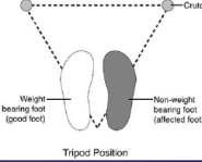 BOT 1, 3, 4 lábú Növeli a stabilitást A testsúly kb.