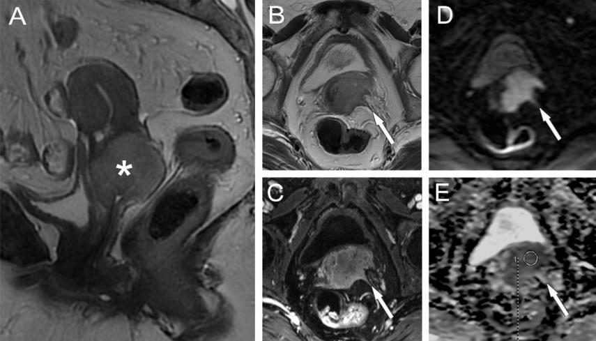 Mágneses rezonanciás vizsgálat (MRI) (Hüttl-Gődény 1993, Gődény 2002, 2004 Magy., Onk.