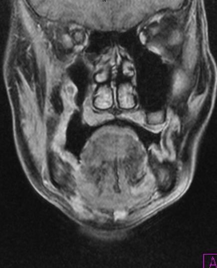A molekuláris képalkotás különböző módszerei (főleg nukleáris medicina és a funkcionális MRI módszerek) az anatómiai jellegzetességeken túl olyan biológiai, biokémiai információt nyújtanak, mely