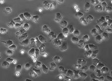 6.2.2 A dasatinib hatása a neutrofil granulociták további adhézió-függő sejtválaszaira A