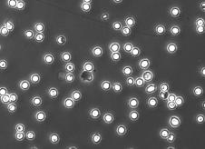 1 nm dasatinib Szétterült sejtek (%) 1 75 5 25 Kontroll IC 1 3 1 Szuperoxid-termelés (nmol/1 6