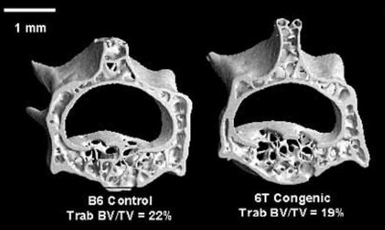 2.3%. However, by uct there was a nearly 20 % difference in bone