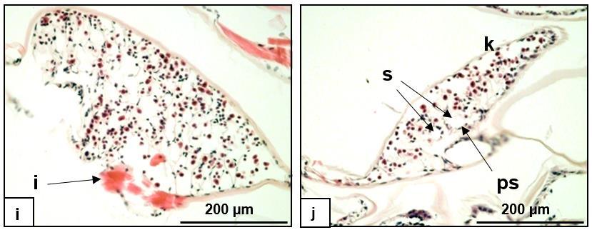 h hemolimfa, i izomköteg, k