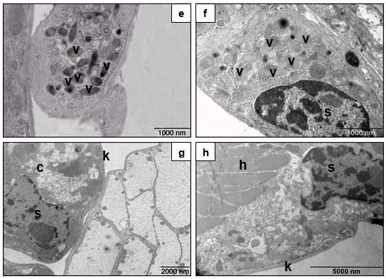 44. ábra: A cotyledon finomszerkezete (TEM). a: A Trachelipus rathkii faj első cotyledonjának középső része.